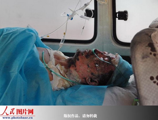 贵州黔西发生特大瓦斯爆炸事故 死亡7人